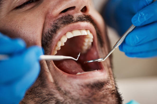 Best Teeth Whitening  in Dent, OH
